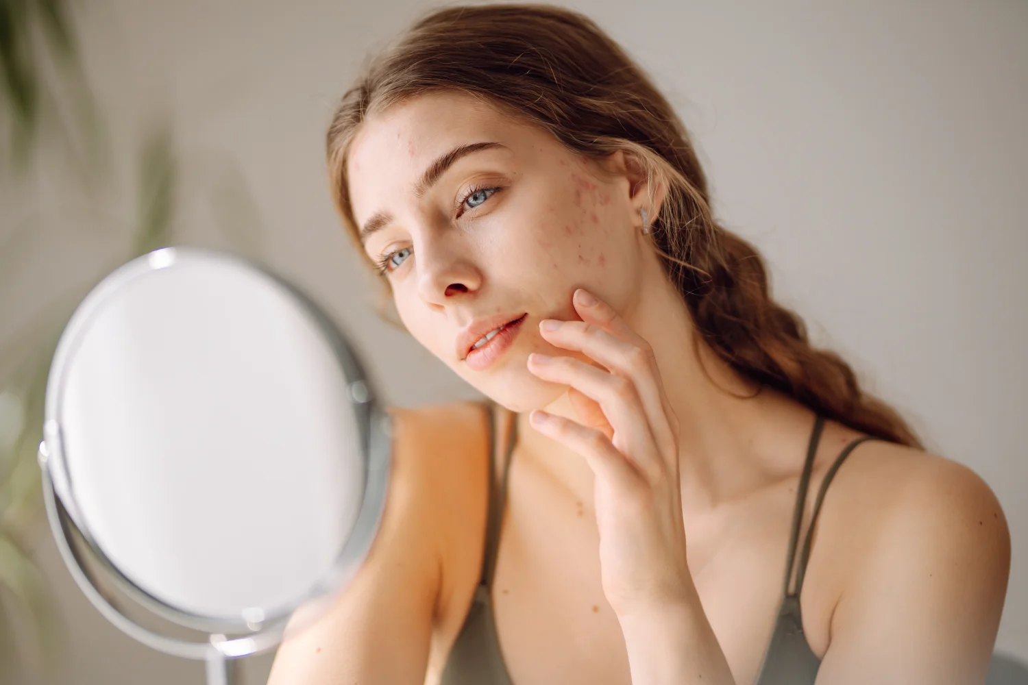 Acne and Rosacea Treatments by Skin by Meghan Dinneen in Caribou, ME