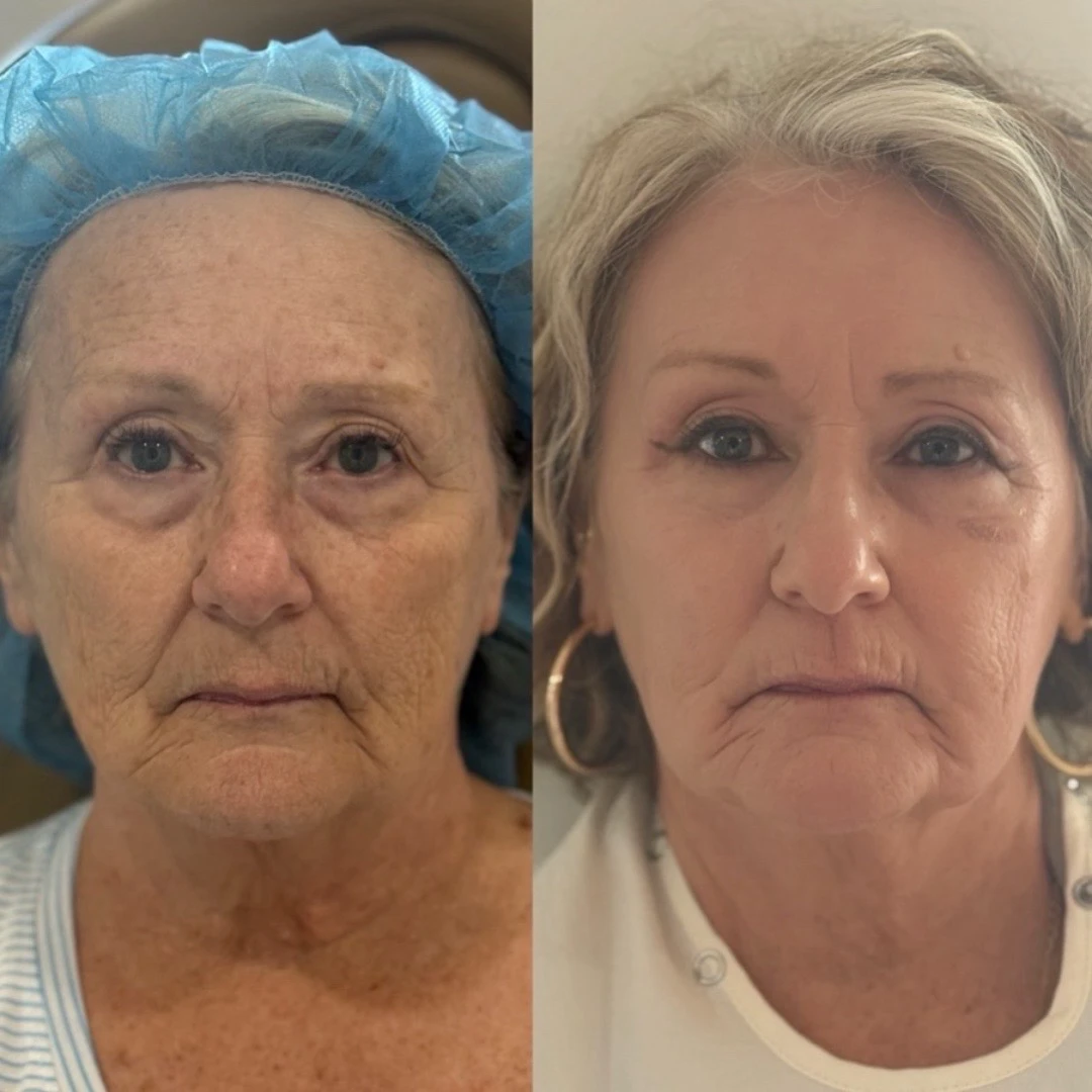 skinmeghandinneen B&A - a