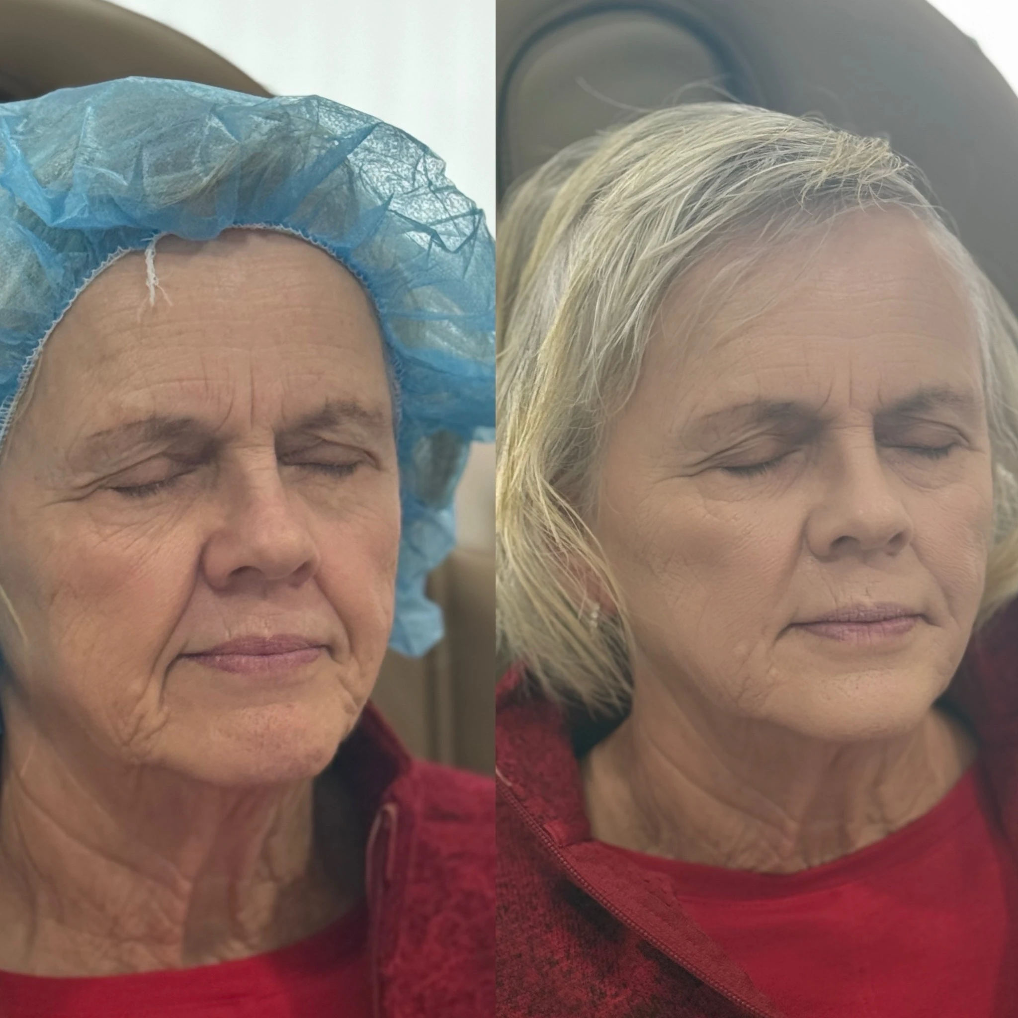 skinmeghandinneen B&A - b