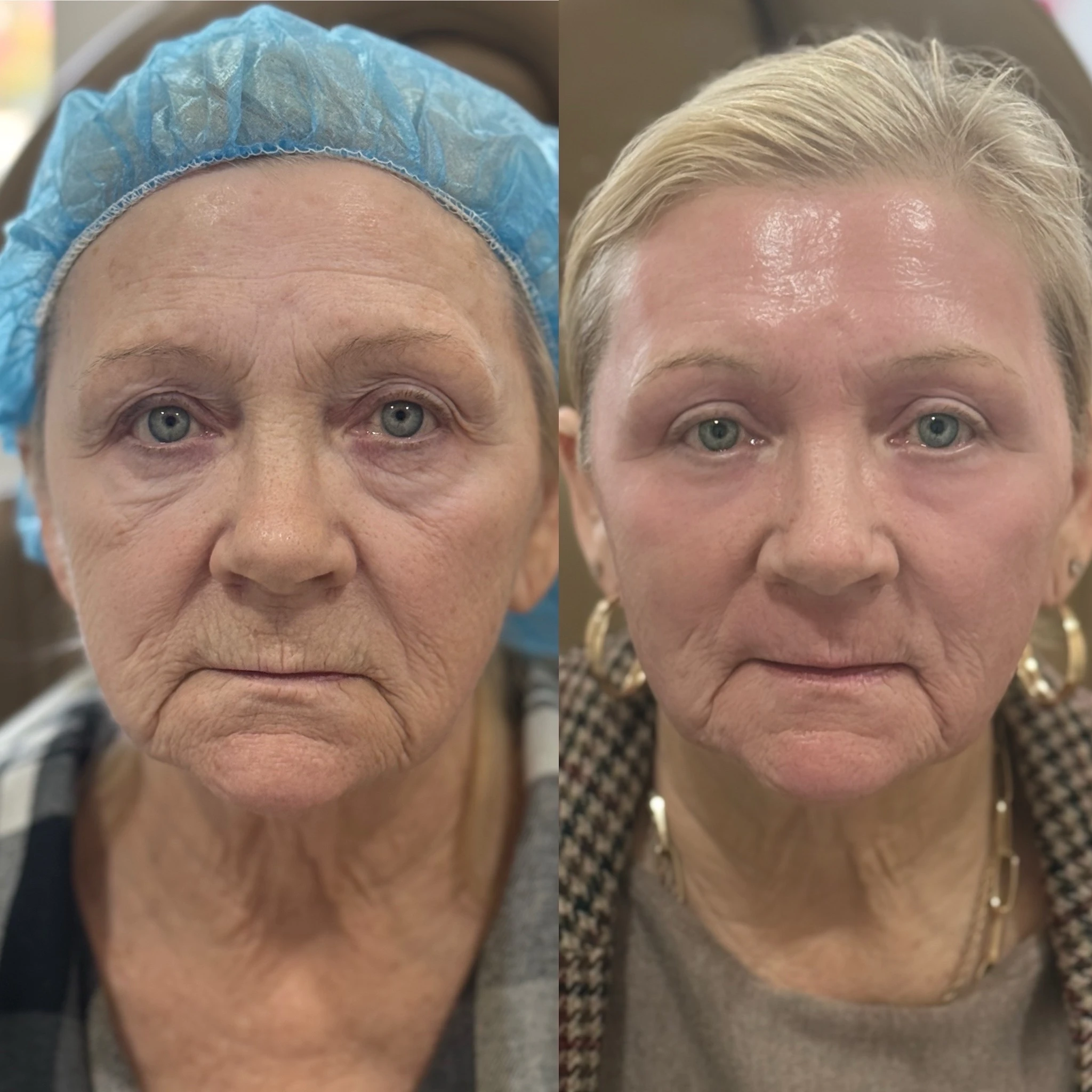 skinmeghandinneen B&A - c