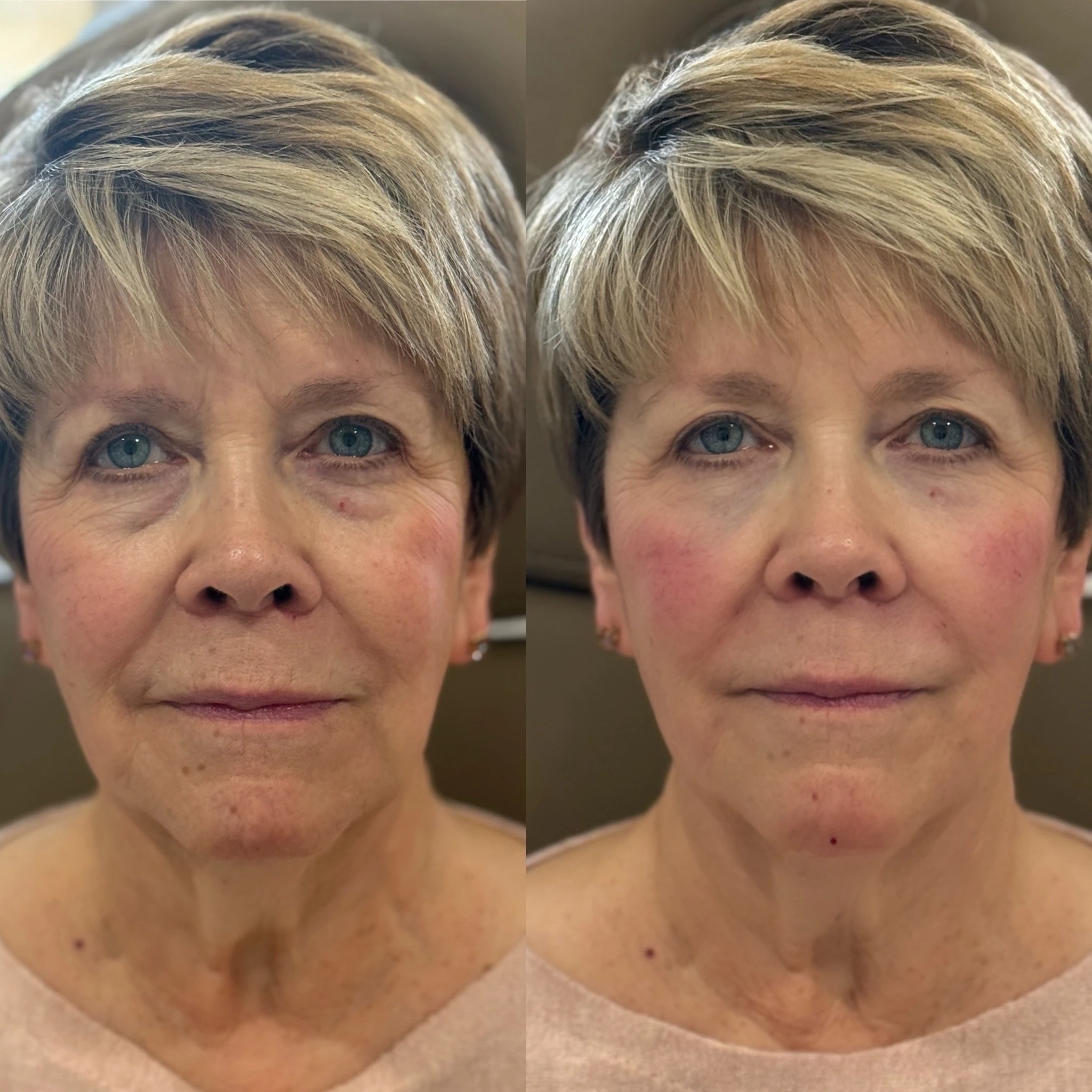 skinmeghandinneen B&A - d