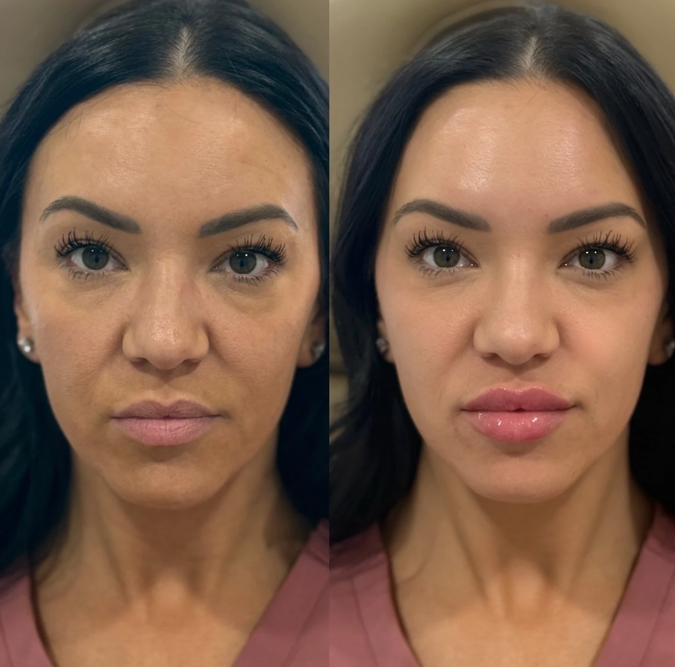 skinmeghandinneen B&A - f