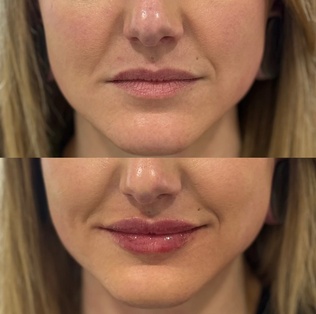 skinmeghandinneen B&A - g