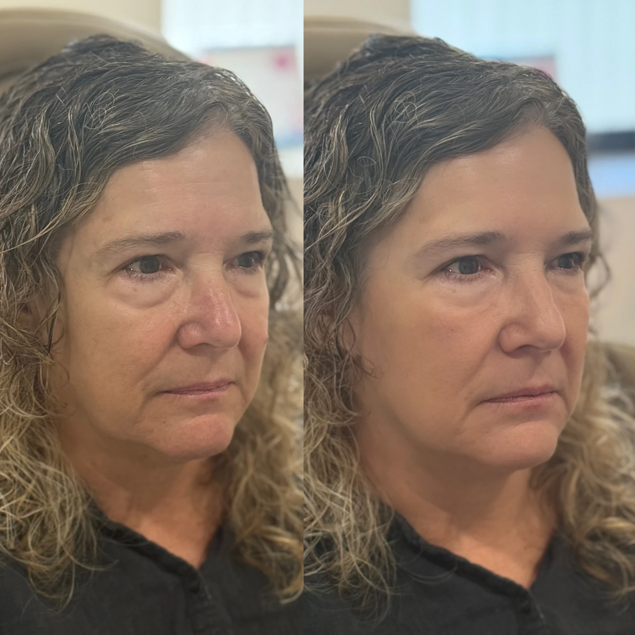 skinmeghandinneen B&A - h